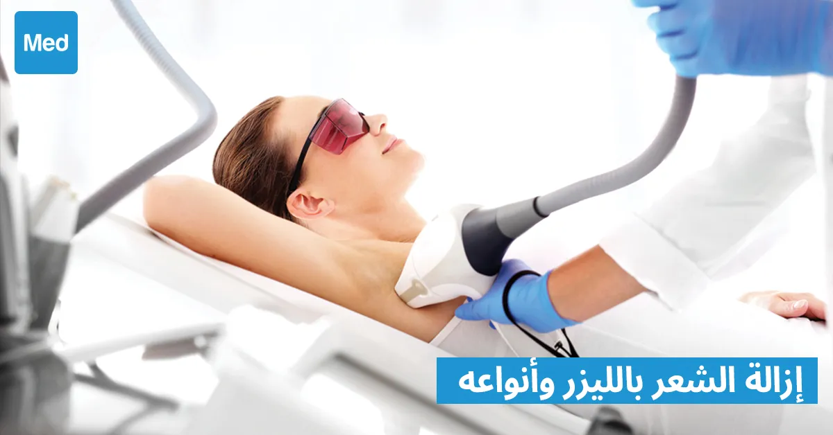 إزالة الشعر بالليزر وأنواعه